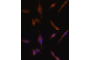 Immunofluorescence analysis of NIH-3T3 cells using MLPH antibody (ABIN6128273, ABIN6143892, ABIN6143893 and ABIN6222354) at dilution of 1:100. (Melanophilin anticorps  (AA 301-600))