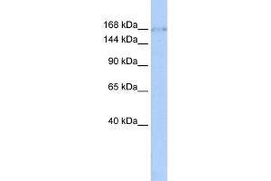 WB Suggested Anti-ZNF608 Antibody Titration:  0. (ZNF608 anticorps  (Middle Region))