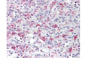 Anti-EZH1 antibody IHC of human spleen.