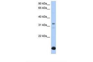 Image no. 1 for anti-UDP-Gal:betaGal beta 1,3-Galactosyltransferase Polypeptide 6 (B3GALT6) (AA 110-159) antibody (ABIN6739269)