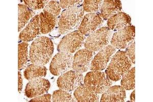 Immunohistochemical analysis of paraffin-embedded human skeletal muscle using Raptor antibody at 1:25 dilution.