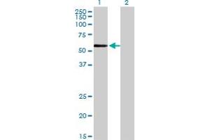 Western Blot analysis of ZNF165 expression in transfected 293T cell line by ZNF165 monoclonal antibody (M02), clone 2B8. (ZNF165 anticorps  (AA 1-485))
