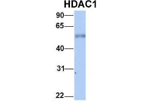 Host:  Rabbit  Target Name:  HDAC1  Sample Type:  Human Fetal Heart  Antibody Dilution:  1.