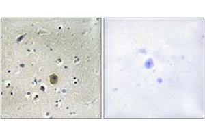 Immunohistochemistry analysis of paraffin-embedded human brain tissue, using MEK1 (Ab-298) Antibody. (MEK1 anticorps  (AA 264-313))