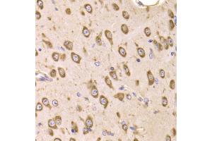 Immunohistochemistry of paraffin-embedded mouse brain using EEF1B2 Antibody (ABIN5973953) at dilution of 1/100 (40x lens). (EEF1B2 anticorps)