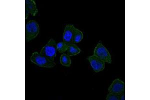 Immunofluorescence analysis of HepG2 cells using HFE mouse mAb (green). (HFE anticorps)