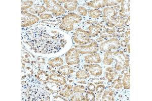 anti-Basal Cell Adhesion Molecule (Lutheran Blood Group) (BCAM) (Middle Region) antibody