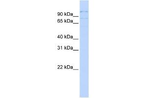 WB Suggested Anti-RBM12 Antibody Titration:  0. (RBM12 anticorps  (Middle Region))