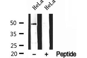 Western blot analysis of extracts of HeLa cells, using DEK antibody. (DEK anticorps  (Internal Region))