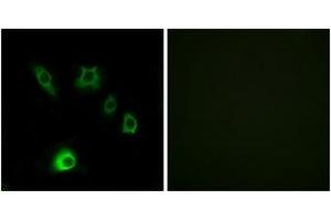 Immunofluorescence analysis of HuvEc cells, using FGF18 Antibody. (FGF18 anticorps  (AA 151-200))