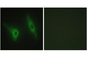 Immunofluorescence analysis of HeLa cells, using CKI-epsilon Antibody. (CK1 epsilon anticorps  (AA 276-325))