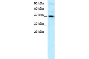 WB Suggested Anti-HNF1B Antibody Titration:  0. (HNF1B anticorps  (N-Term))