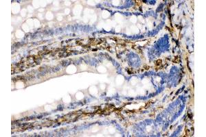 FGF1 was detected in paraffin-embedded sections of rat intestine tissues using rabbit anti- FGF1 Antigen Affinity purified polyclonal antibody (Catalog # ) at 1 µg/mL.