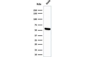 Western Blot Analysis of HeLa cell lysate using HSP60 Monoclonal Antibody (LK1)