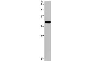 Gel: 10 % SDS-PAGE, Lysate: 40 μg, Lane: Human hepatocellular carcinoma tissue, Primary antibody: (NPHS2 Antibody) at dilution 1/200, Secondary antibody: Goat anti rabbit IgG at 1/8000 dilution, Exposure time: 2 minutes (Podocin anticorps)