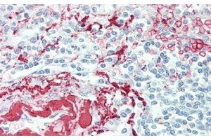 Detection of TPOR in Human Spleen Tissue using Polyclonal Antibody to Thrombopoietin Receptor (TPOR)