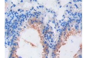 Detection of FGF6 in Mouse Lung Tissue using Polyclonal Antibody to Fibroblast Growth Factor 6 (FGF6)