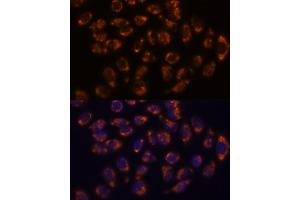 Immunofluorescence analysis of HeLa cells using CRELD1 antibody (ABIN7266621) at dilution of 1:100. (CRELD1 anticorps  (AA 50-150))