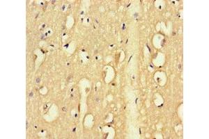 Immunohistochemistry of paraffin-embedded human brain tissue using ABIN7171786 at dilution of 1:100 (FAM46C anticorps  (AA 1-391))
