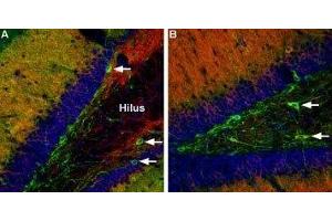 Multiplex staining of CaV1.