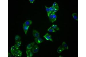 Immunofluorescence staining of Hela cells with ABIN7127774 at 1:36, counter-stained with DAPI. (Recombinant PRKAR1A anticorps)