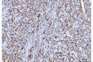 IHC analysis of CD147/Emmprin using anti-CD147/Emmprin antibody (ABIN7599997).