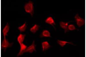 ABIN6266963 staining K562 by IF/ICC.