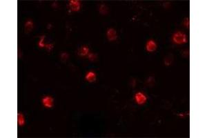 Immunofluorescencent staining of Daudi cells with CD244 polyclonal antibody  at 20 ug/mL. (2B4 anticorps  (C-Term))
