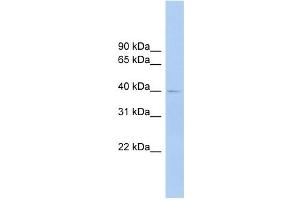 FCRLA antibody used at 1 ug/ml to detect target protein. (FCRLA anticorps  (Middle Region))