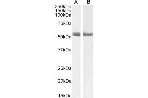 ABIN185366 (1µg/ml) staining of Human Breast (A) and Breast cancer (B) lysate (35µg protein in RIPA buffer). (Retinoic Acid Receptor alpha anticorps  (C-Term))