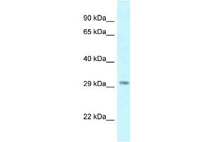 Antibody Titration: 1. (SUV420H1 anticorps  (C-Term))