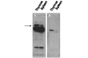 Western blot using  affinity purified anti-Pogz antibody shows detection of Pogz protein (arrowhead) in adult mouse thymus and spleen tissue lysate (Panel A). (POGZ anticorps  (N-Term))