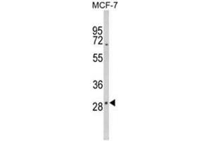 Western blot analysis of DIO2 Antibody (Center) in MCF-7 cell line lysates (35ug/lane).
