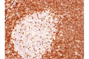 Formalin-fixed, paraffin-embedded human Tonsil stained with Bcl-2 Mouse Monoclonal Antibody (8C8).