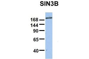 Host:  Rabbit  Target Name:  SIN3B  Sample Type:  Human Fetal Brain  Antibody Dilution:  1. (SIN3B anticorps  (Middle Region))