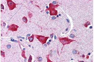 Brain, cortex (NMUR2 anticorps  (N-Term))