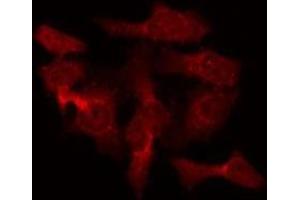 ABIN6275469 staining Hela by IF/ICC. (RAB40B anticorps  (C-Term))