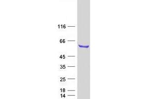 Validation with Western Blot