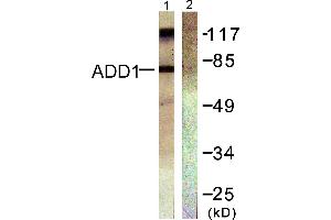 Western blot analysis of extracts from Hela cells treated with Forskolin (40nM, 30min), using ADD1 (Ab-726) antibody (#B0002, Line 1 and 2). (alpha Adducin anticorps  (Ser726))