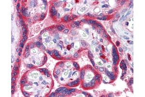 Anti-ADAM15 antibody IHC of human placenta.