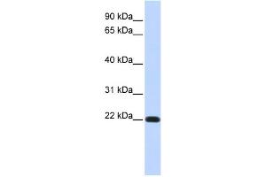 WB Suggested Anti-FXYD5 Antibody Titration:  0. (FXYD5 anticorps  (Middle Region))