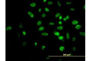 Image no. 7 for anti-V-Akt Murine Thymoma Viral Oncogene Homolog 2 (AKT2) (AA 100-189) antibody (ABIN599349) (AKT2 anticorps  (AA 100-189))