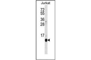 Western blot analysis of POLR2G Antibody (C-term) in Jurkat cell line lysates (35ug/lane). (POLR2G anticorps  (C-Term))