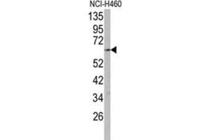 Western Blotting (WB) image for anti-Cytochrome P450, Family 2, Subfamily R, Polypeptide 1 (CYP2R1) antibody (ABIN3003558)