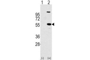 Western blot analysis of ALDH1A1 antibody and 293 cell lysate (2 ug/lane) either nontransfected (Lane 1) or transiently transfected with the ALDH1A1 gene (2). (ALDH1A1 anticorps  (AA 302-331))