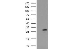 Image no. 1 for anti-Ubiquitin-Conjugating Enzyme E2S (UBE2S) antibody (ABIN1501646) (UBE2S anticorps)
