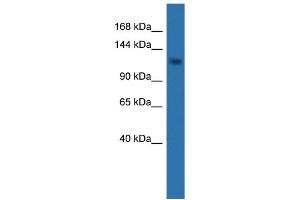 WB Suggested Anti-CDKL5  Antibody Titration: 0. (CDKL5 anticorps  (C-Term))