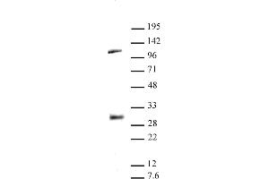LIN28A antibody (pAb) tested by Western blot. (LIN28A anticorps  (C-Term))