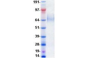 Validation with Western Blot