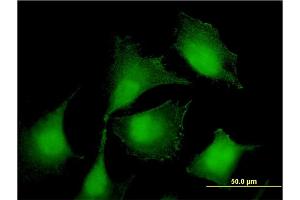 Immunofluorescence of monoclonal antibody to RIOK2 on HeLa cell. (RIOK2 anticorps  (AA 453-551))